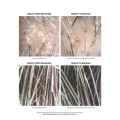 Złuszczająco - nawilżający peeling do skalpu z 3,2% kompleksem kwasów AHA/BHA i 1% sokiem z aloesu Feel The Peel 150 ml - Veoli Botanica